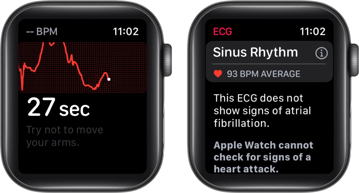 Une fois le compte à rebours terminé, consultez vos résultats sur Apple Watch