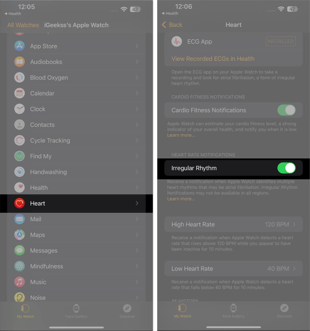 Activer le rythme irrégulier dans l'application Watch sur iPhone